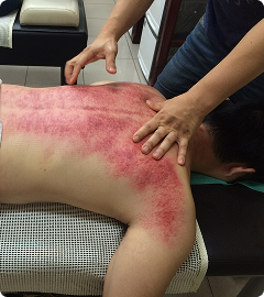 treatment-4